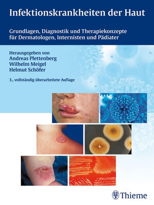 cover image of Infektionskrankheiten der Haut